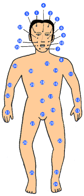 Nốt ruồi thân hình (xem chung nam & nữ)